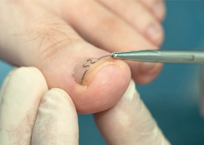 Quanto um podólogo cobra